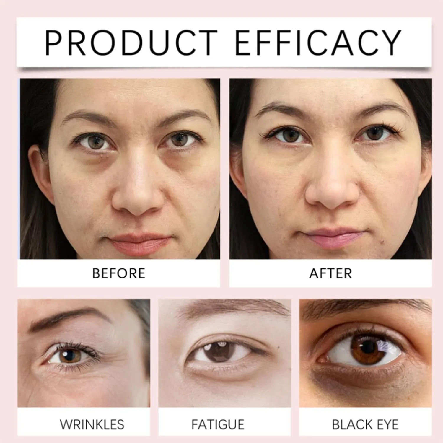 Gentian Anti-Wrinkle Eye Cream, Gentian Eye Cream, Gentian Anti-Wrinkle Firming Eye Cream, Gentian Eye Cream for Eye Bags, Dark Circles Puffiness and Bags Under Eyes