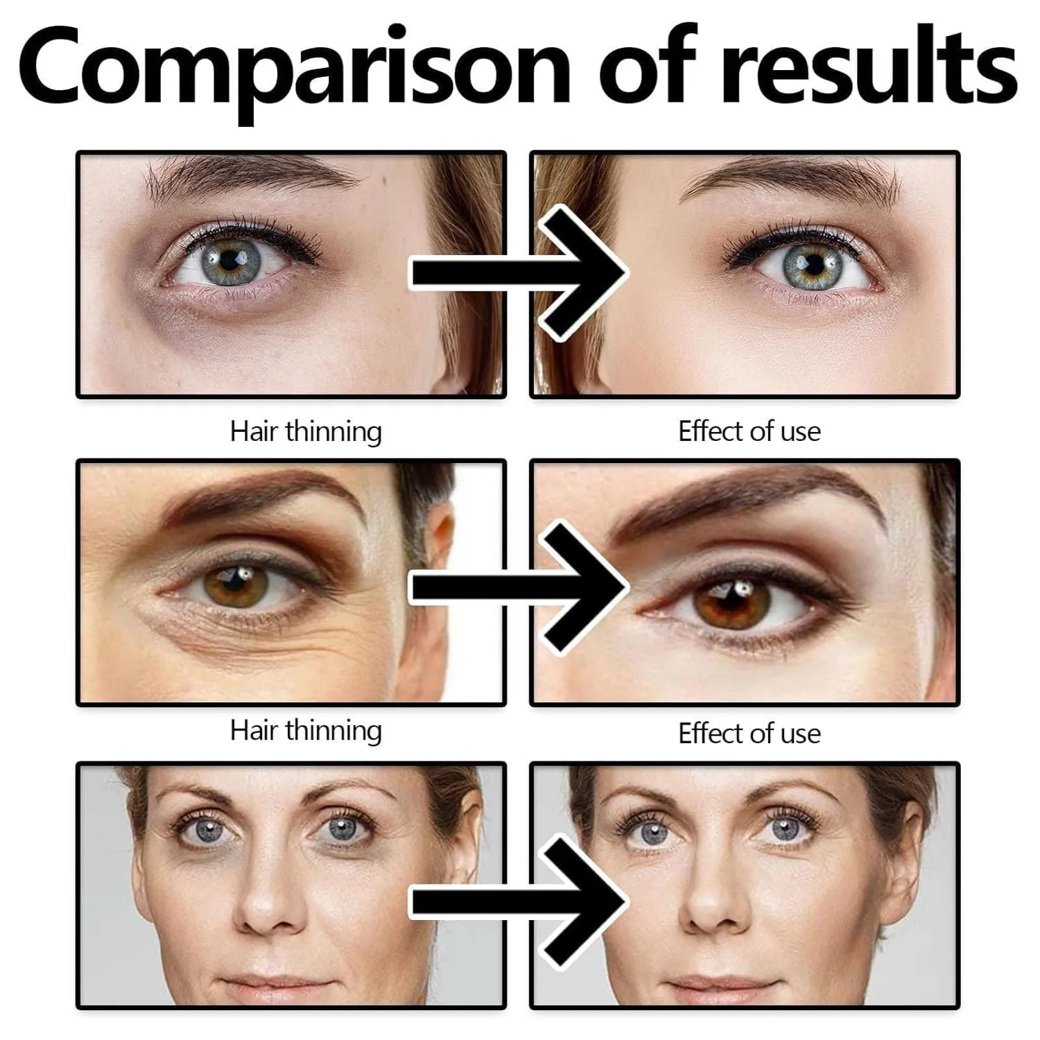 Instant Eyes Lift, Instant Face Tightener Cream, Face, Neck, Eye Lifting & Firming Cream, Under Eye Cream for Puffy Eye Bags Fine Lines (2)